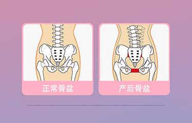 盆底肌修復(fù)儀器怎么樣？哪些人可以使用它呢