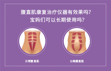 腹直肌康復(fù)治療儀器有效果嗎？寶媽們可以長(zhǎng)期使用嗎？